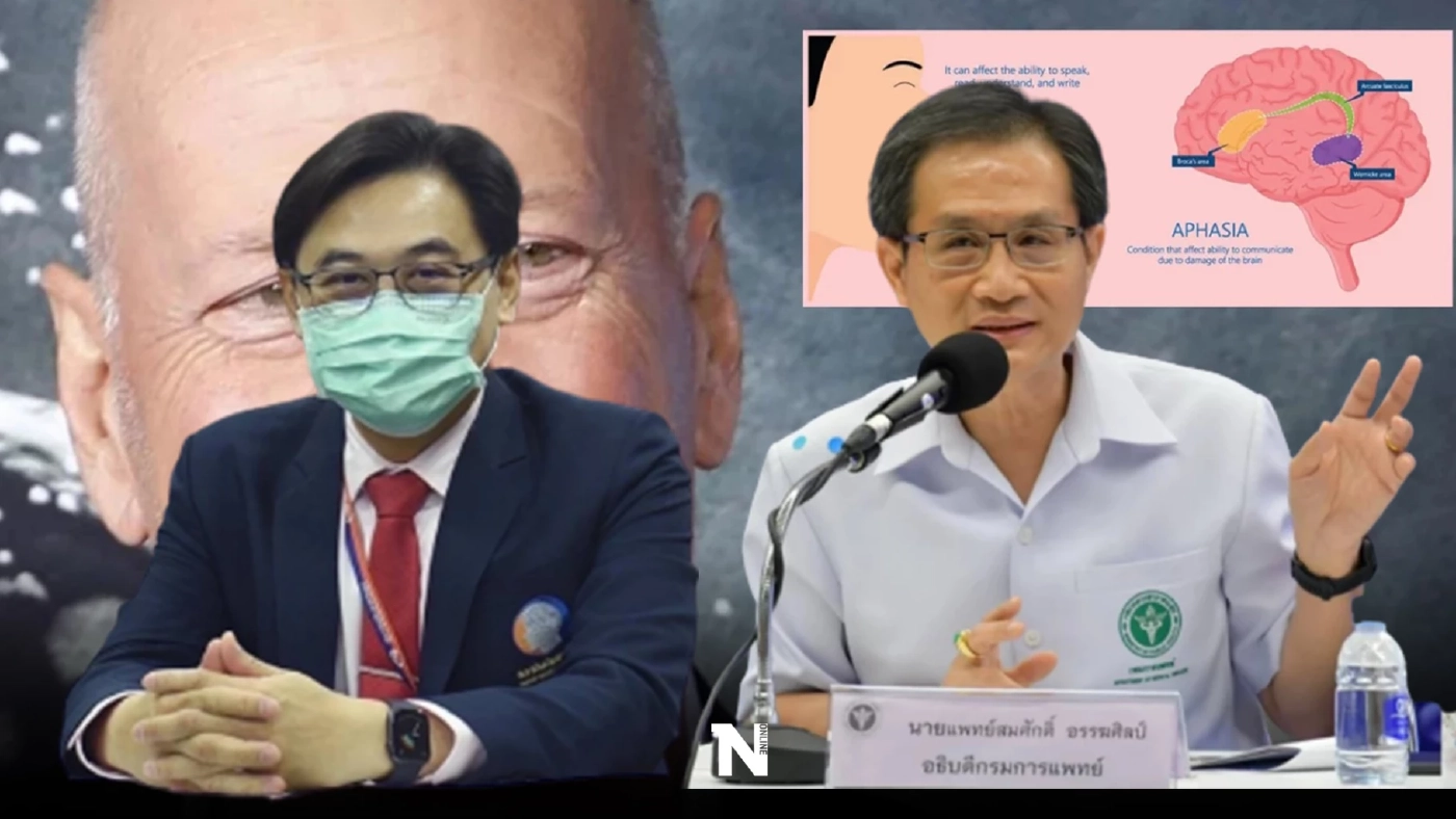 แพทย์แนะนำ ป่วยโรคอะเฟเซีย อย่าวางใจ ควรรีบพบแพทย์ทันที