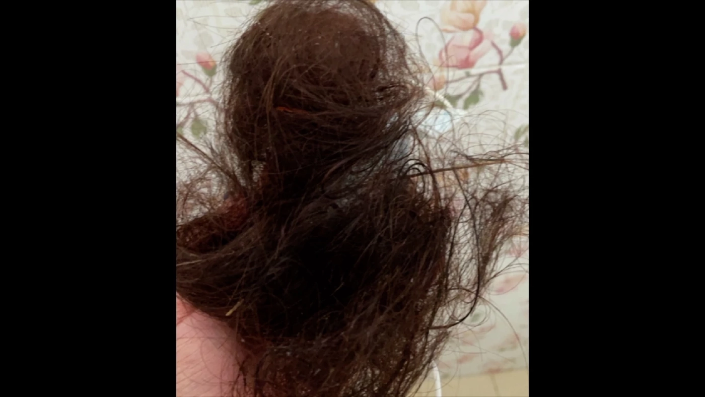 สาวร้อง!ยืดผมร้านเสริมสวย สุดท้ายผมร่วงทั้งศีรษะ