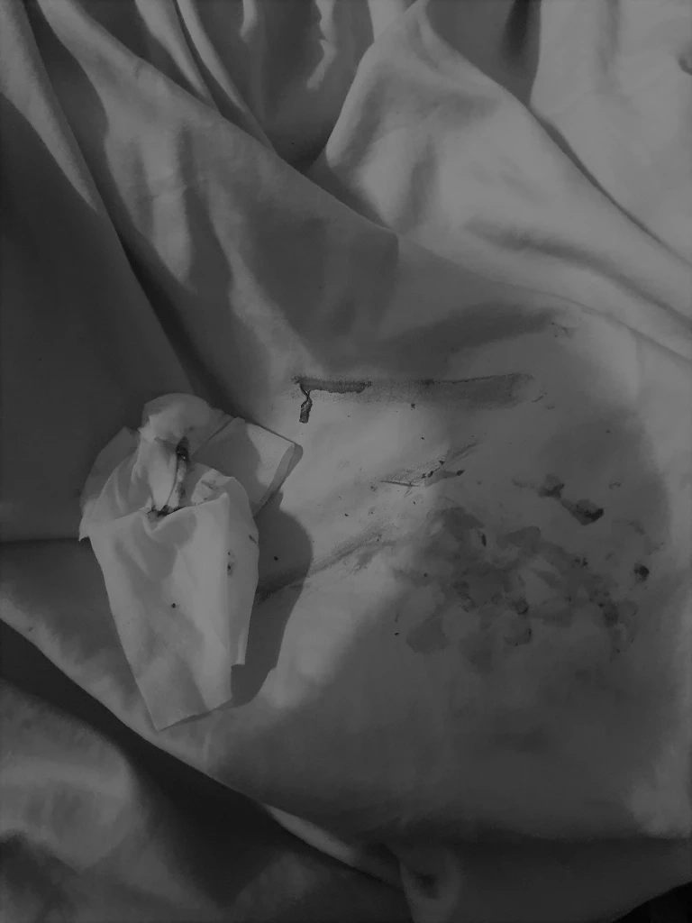 ดราม่าลูกค้าปล่อยหมาอึหมกผ้าห่มรีสอร์ต  ล่าสุดเจ้าของหมาเคลื่อนไหวแล้ว