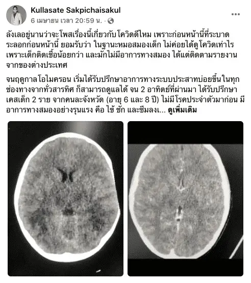 แพทย์แนะนำ สังเกตอาการเด็กติดโควิด แม้ไม่มีโรคประจำตัว สุดท้ายเสียชีวิต