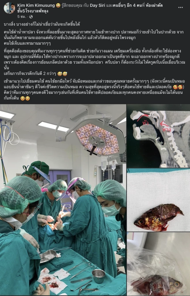 สยอง !! "ปลาหมอ" เข้าปากติดลำคอคนหาปลา แพทย์โรงพยาบาลพัทลุงช่วยผ่าจนรอดตาย