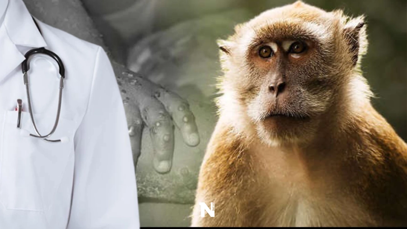 "ฝีดาษลิง" ลามถึงลาตินอเมริกา ล่าสุดพบผู้ป่วยรายแรกที่ อาร์เจนตินา