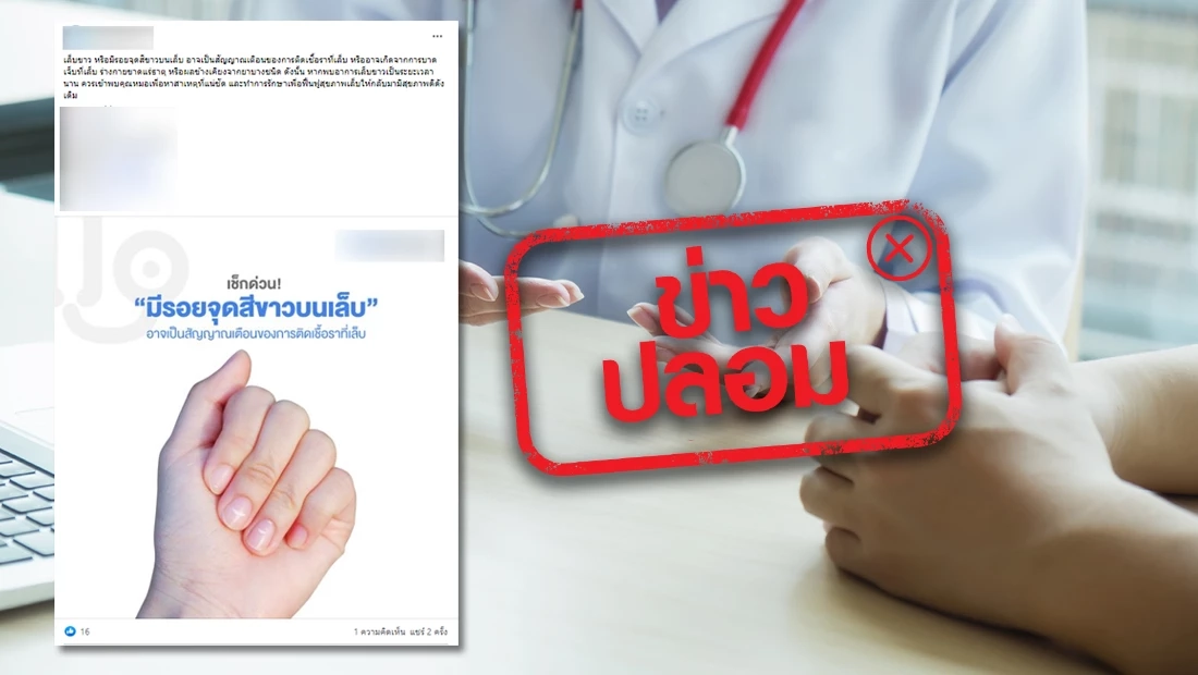 ไขคำตอบ "รอยจุดสีขาวบนเล็บ" คืออะไร อาการแบบไหนต้องไปพบแพทย์