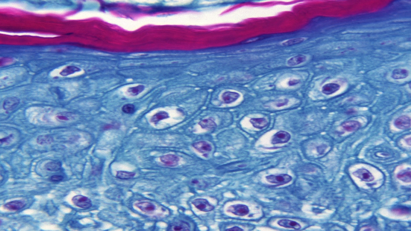 WHO ยันฝีดาษลิงยังไม่กลายพันธุ์ ควบคุมได้ไม่ต้องฉีดวัคซีน