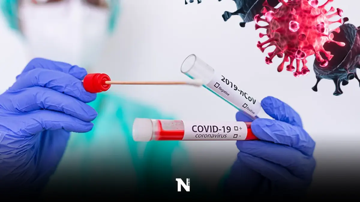 กองวัณโรค รับตรวจโควิด-19 RT-PCR และ ATK รับจองคิวออนไลน์เท่านั้น