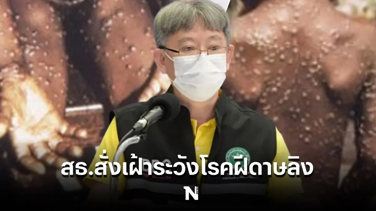 สธ. เตือนปชช.เฝ้าระวังโรคฝีดาษลิง ติดจากสัตว์สู่คน-คนสู่คนได้