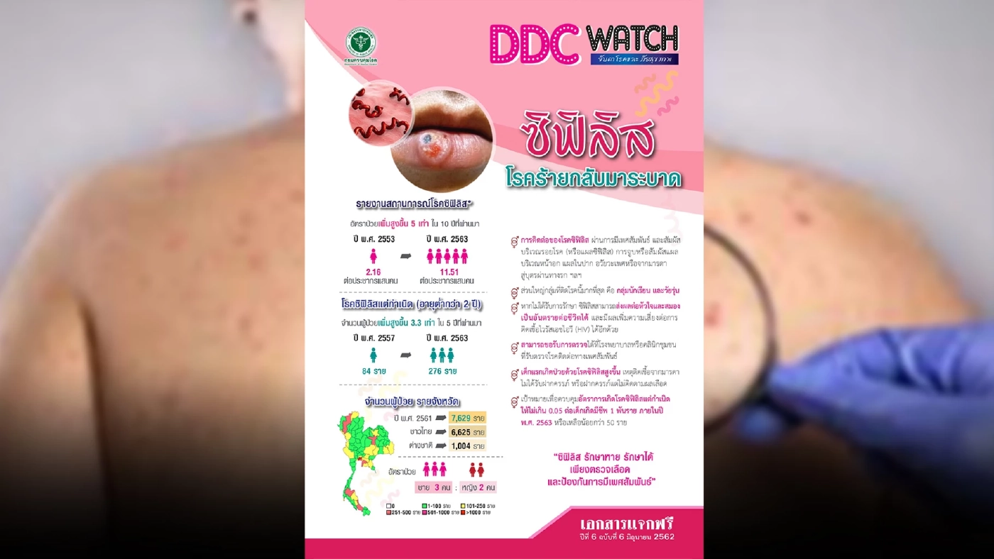 ระวัง!!“โรคซิฟิลิส”โรคร้ายติดได้..แม้ไม่ได้มีเพศสัมพันธ์