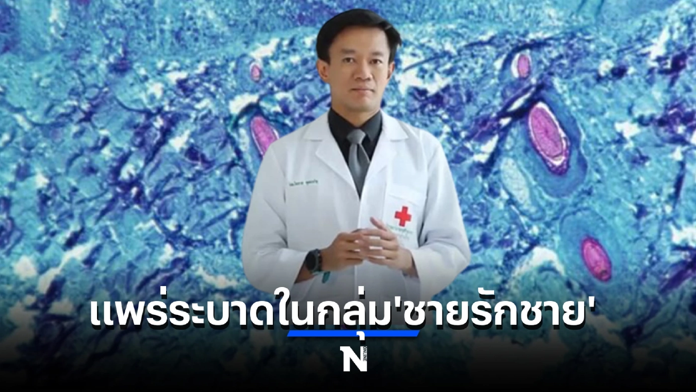 หมอเผย กลุ่มชายรักชายเสี่ยงสูง "โรคฝีดาษลิง" หลังเกิดคลัสเตอร์ในสเปน
