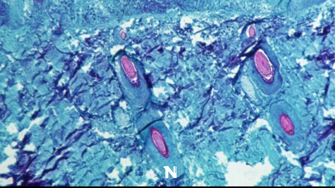 อ.เจษฎา ชี้ ไทยมีโอกาสเจอ โรคฝีดาษลิง แต่ถือเป็นโรคไม่น่าเป็นห่วงมากนัก