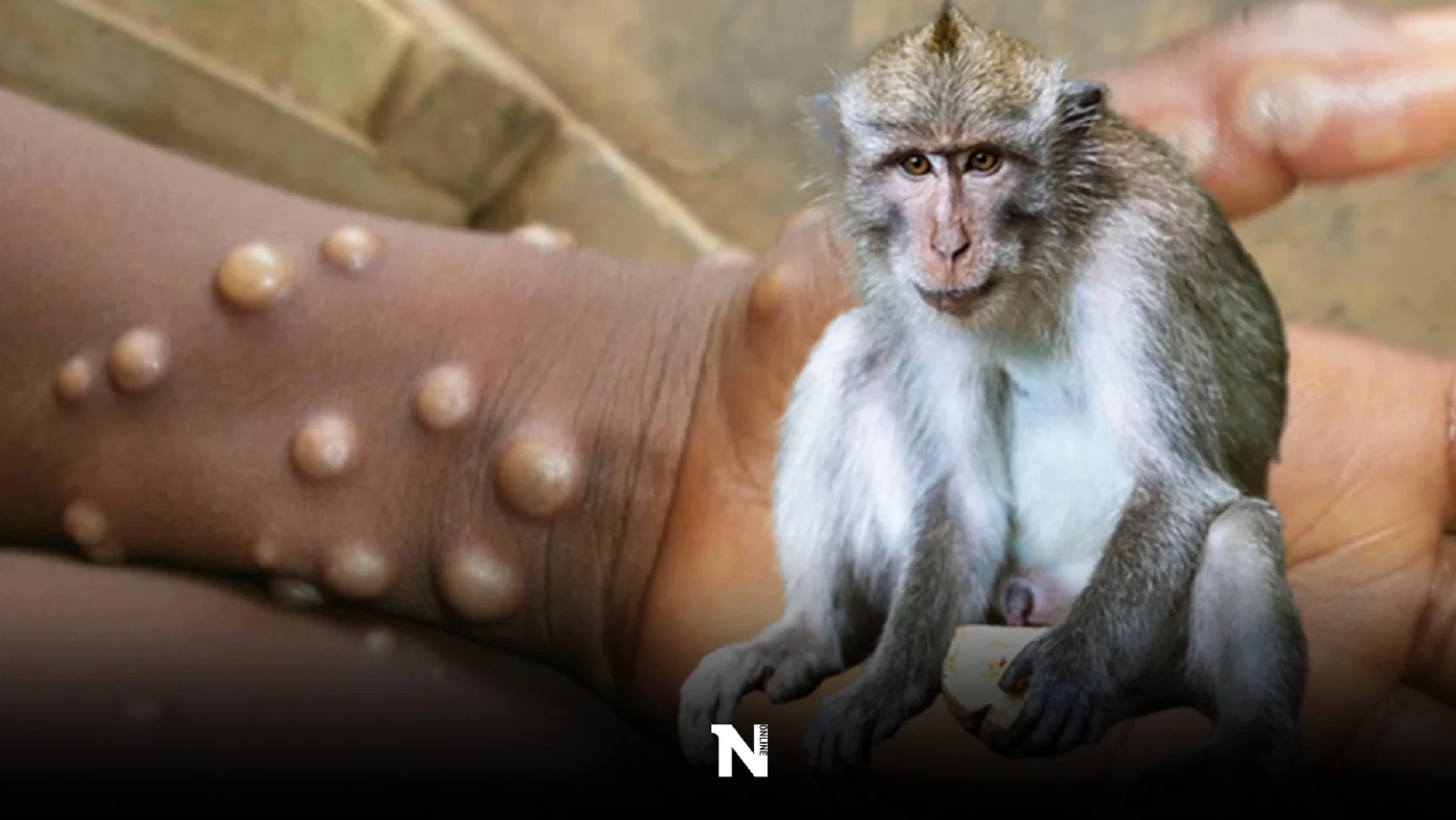 WHO ชี้การระบาด "ฝีดาษลิง" น่ากังวล พบผู้ติดเชื้อ 80 รายใน 11 ประเทศ