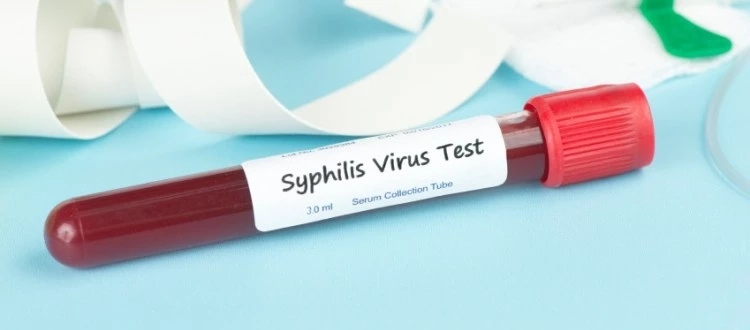 ระวัง!!“โรคซิฟิลิส”โรคร้ายติดได้..แม้ไม่ได้มีเพศสัมพันธ์