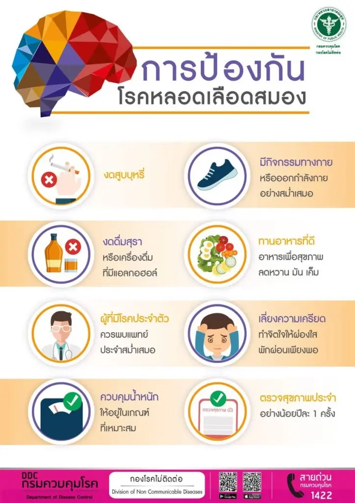เตือนภัยเงียบของ ‘โรคหลอดเลือดสมอง’ อันตรายมากกว่าที่คิด