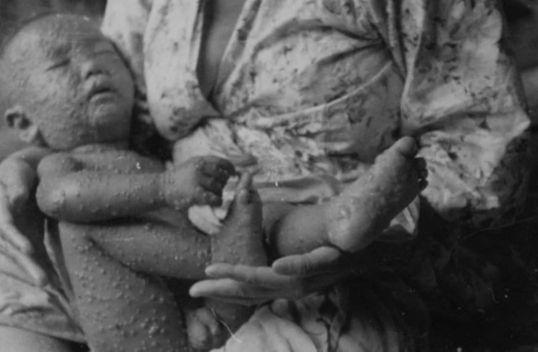 ภาพ : hfocus.org