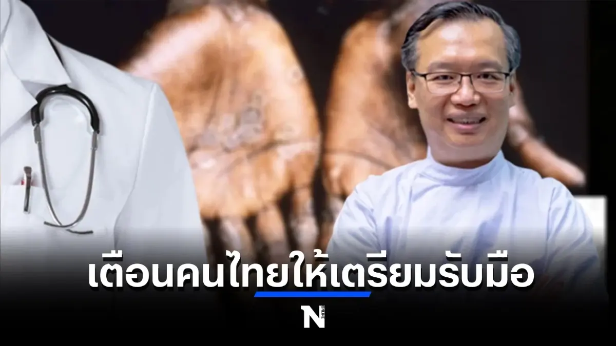 แพทย์เผย ไวรัสฝีดาษลิง ปรับเปลี่ยนโฮสต์ แพร่คนสู่คนง่ายขึ้น เร็วกว่า10เท่า