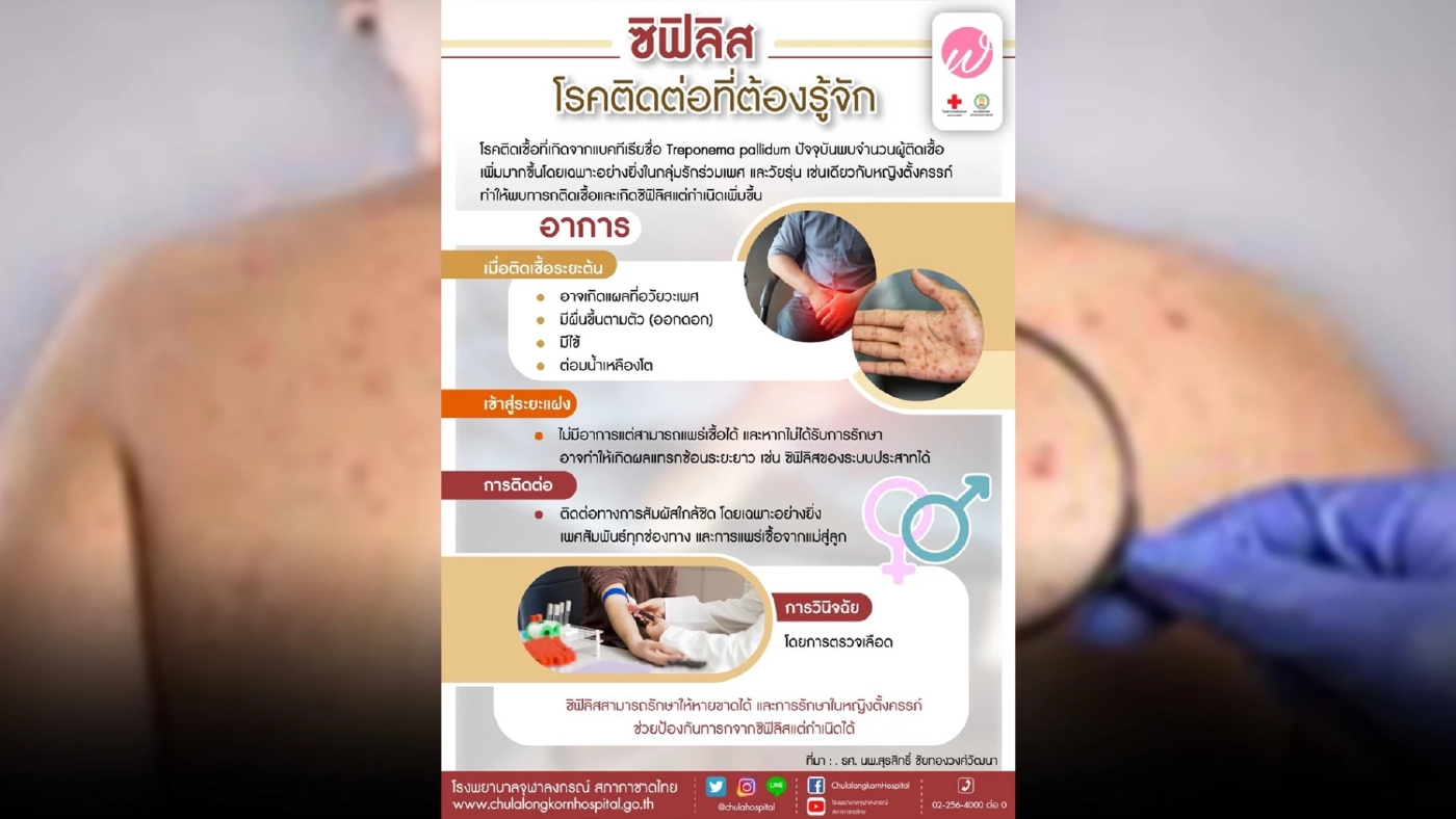 ระวัง!!“โรคซิฟิลิส”โรคร้ายติดได้..แม้ไม่ได้มีเพศสัมพันธ์