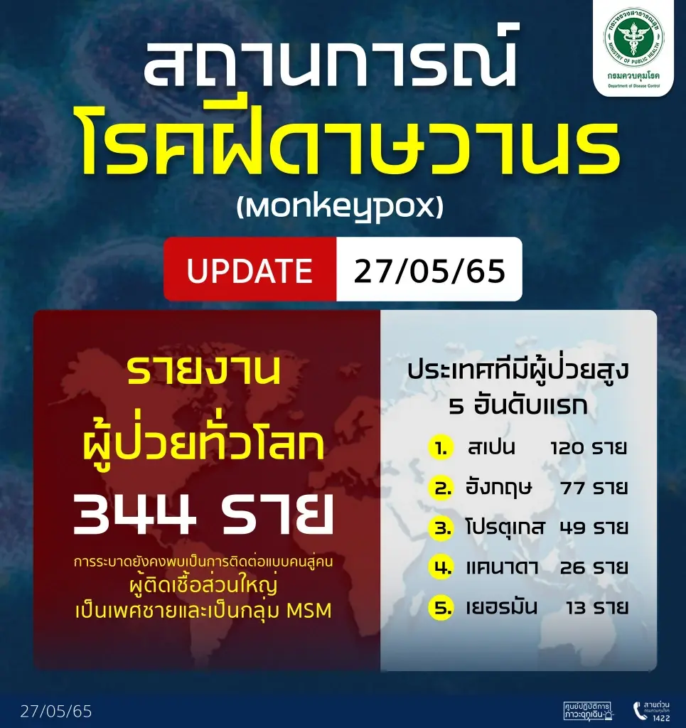 สถานการณ์ "ฝีดาษลิง" ทั่วโลก 344 ราย สธ.เข้มกลุ่มเสี่ยงสังเกตุอาการ 21 วัน