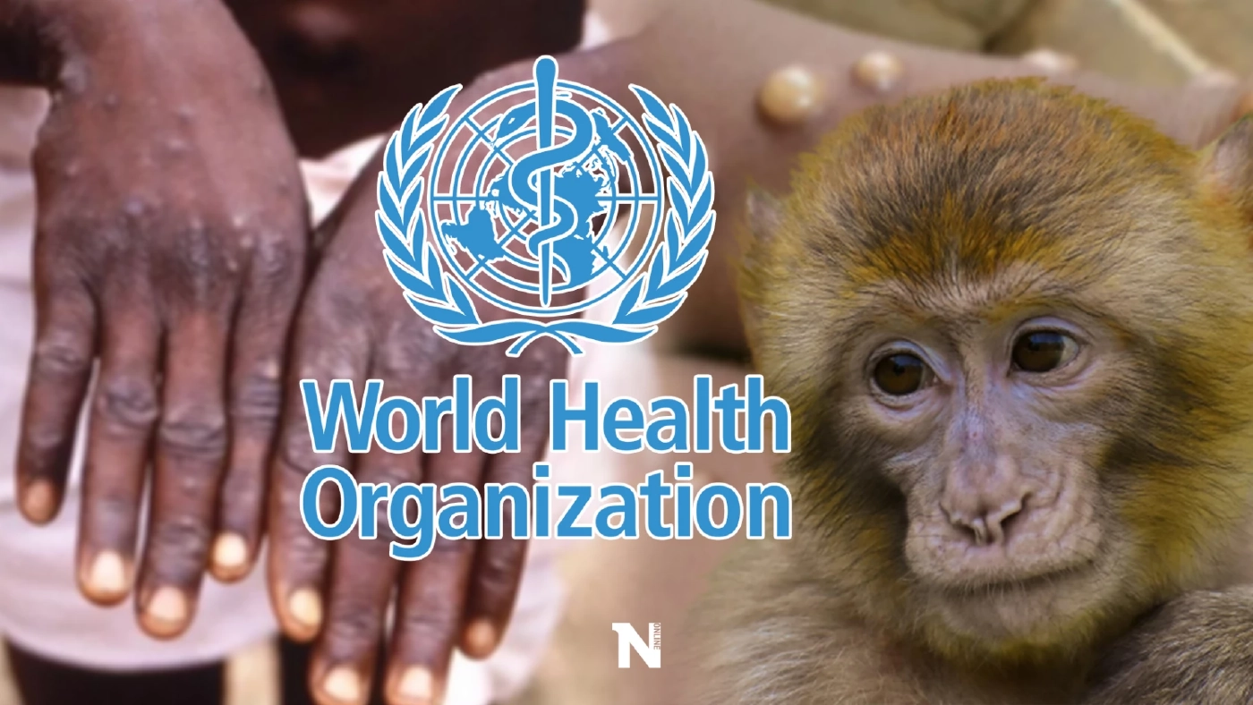 กรมควบคุมโรค ตั้งศูนย์ปฏิบัติการภาวะฉุกเฉินฯ เฝ้าระวัง"ฝีดาษลิง"