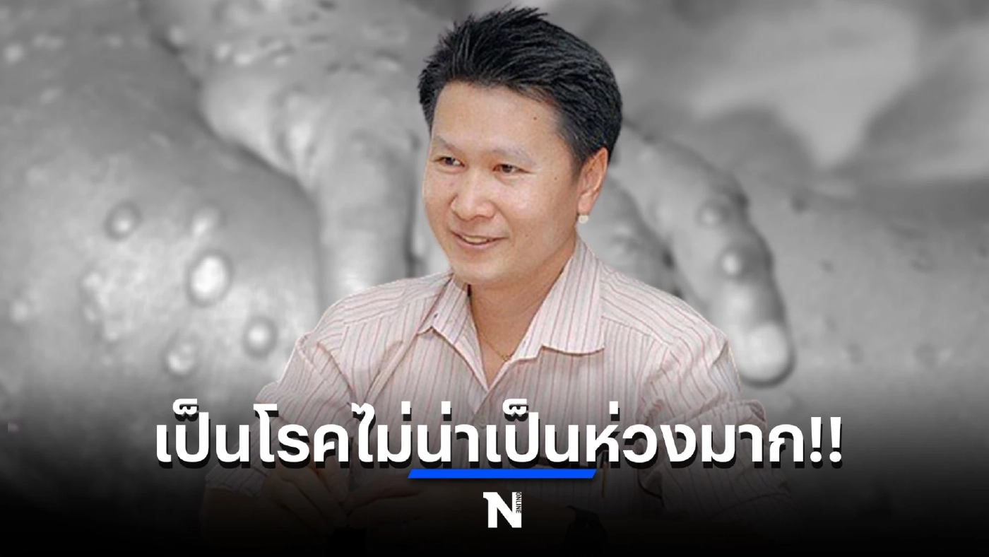 อ.เจษฎา ชี้ ไทยมีโอกาสเจอ โรคฝีดาษลิง แต่ถือเป็นโรคไม่น่าเป็นห่วงมากนัก