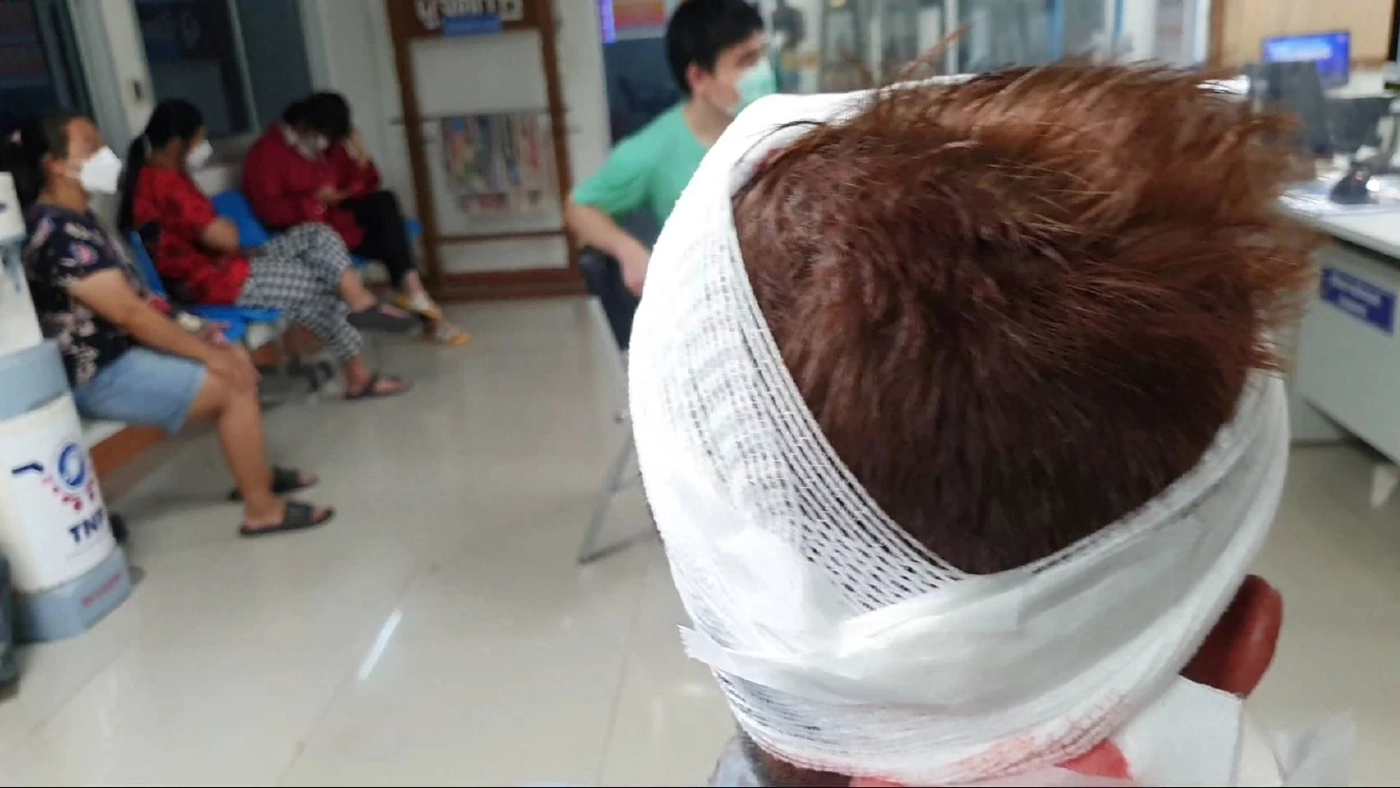 สาวใหญ่ ถูก "พิตบูล" ขย้ำจมรอยเขี้ยวทั่วศรีษะ และลำตัว  รวม 13 แผล