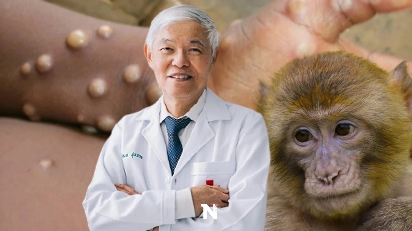 เเนะ 5 วิธีง่ายๆ ป้องกันตนเองและครอบครัว ให้ห่างไกลจาก “โรคฝีดาษลิง”