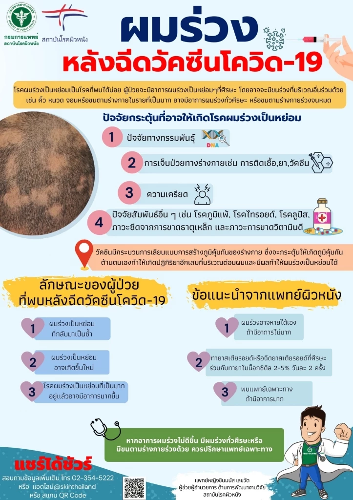 ผมร่วงหลังติดโควิด เกิดขึ้นได้อย่างไร  แพทย์ผิวหนังมีคำตอบ พร้อมวิธีรักษา