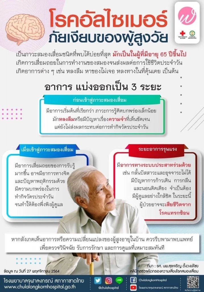 ทำความรู้จัก "อัลไซเมอร์" หมอกรมสุขภาพจิตแนะ ต้องดูแลผู้ป่วยอย่างใกล้ชิด