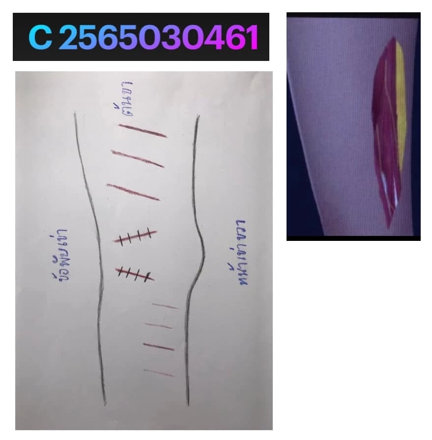 ย้อนความเห็น “หมอธวัชชัย” หลังถูกยกเป็นกุญแจสำคัญไขคดีแตงโม