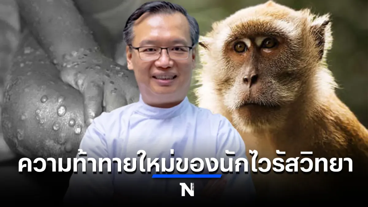 ดร.อนันต์ เผย โรคฝีดาษลิง ถือเป็นหนึ่งความท้าทายใหม่ของบรรดานักไวรัสวิทยา