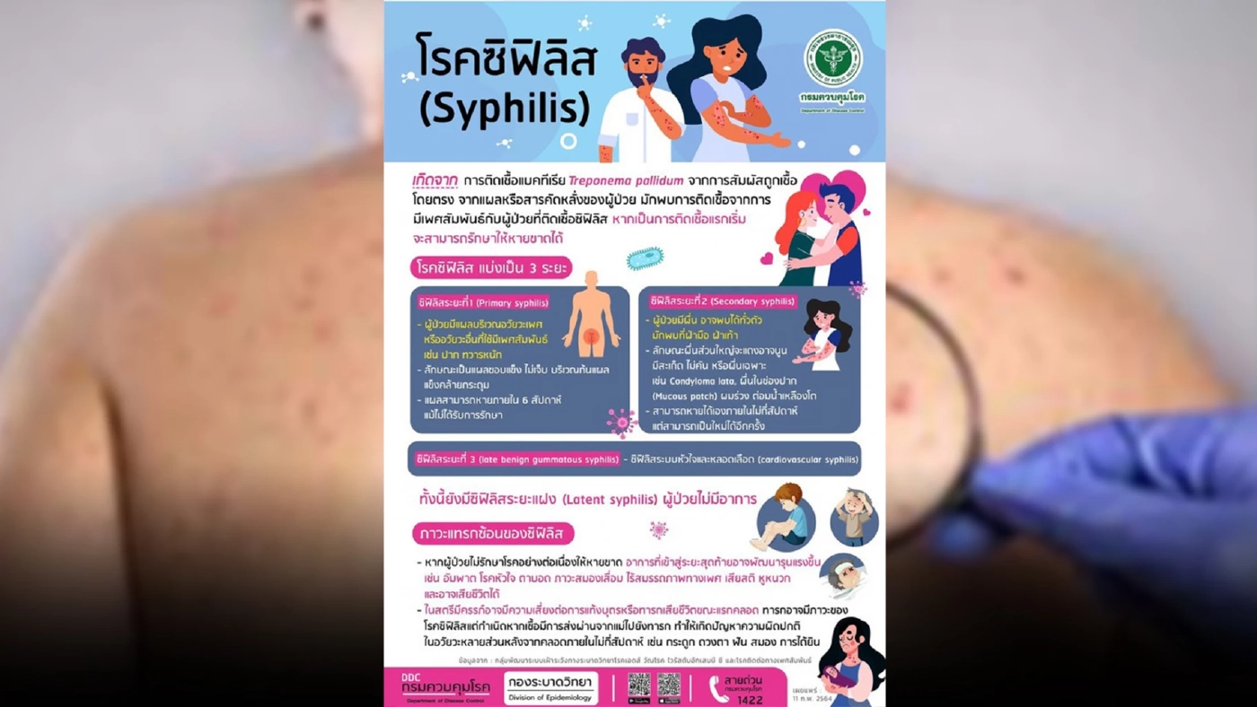 ระวัง!!“โรคซิฟิลิส”โรคร้ายติดได้..แม้ไม่ได้มีเพศสัมพันธ์