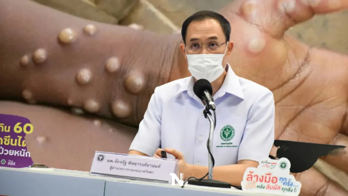 "โรคฝีดาษลิง" กี่วันแพร่เชื้อ เช็ก 6 อาการต้องรู้ หากรุนแรงถึงขั้นตาบอดได้