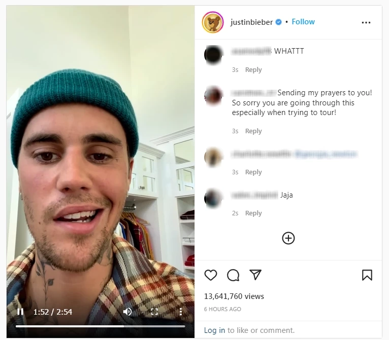 ช็อกแฟนคลับ! จัสติน บีเบอร์ หน้าเป็นอัมพาตเพราะไวรัส (ชมคลิป)