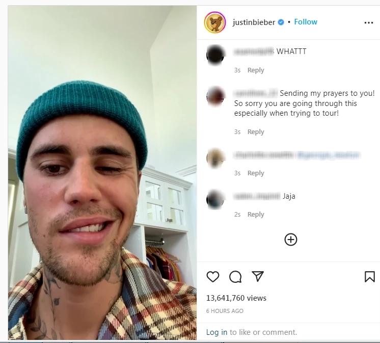 ช็อกแฟนคลับ! จัสติน บีเบอร์ หน้าเป็นอัมพาตเพราะไวรัส (ชมคลิป)