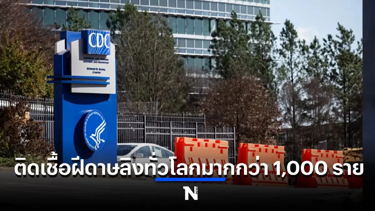 สหรัฐฯ ยกระดับเตือนภัยฝีดาษลิง หลังพบผู้ติดเชื้อทั่วโลกพุ่งทะลุ 1,000 ราย