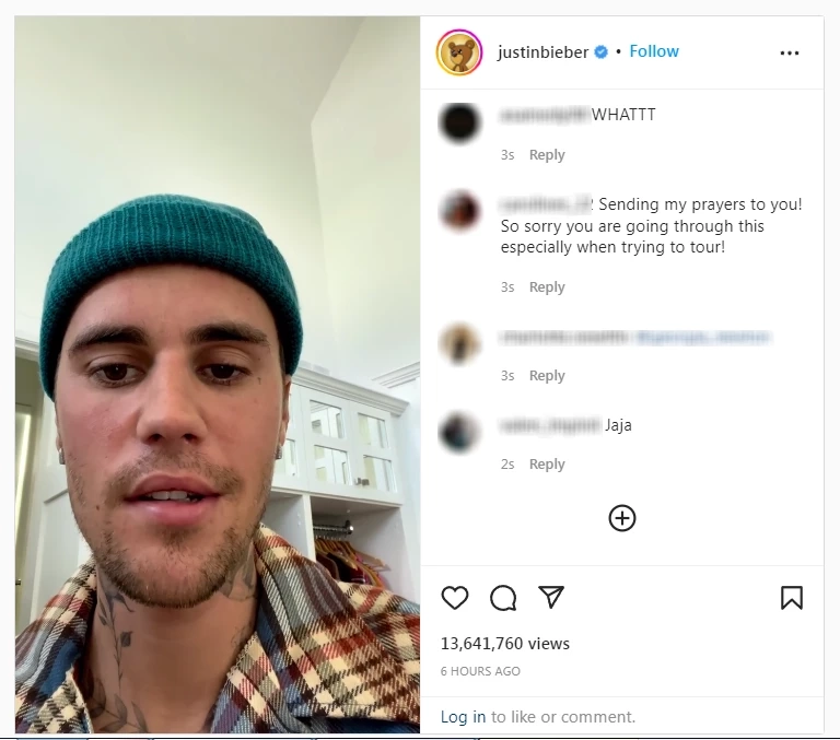 ช็อกแฟนคลับ! จัสติน บีเบอร์ หน้าเป็นอัมพาตเพราะไวรัส (ชมคลิป)