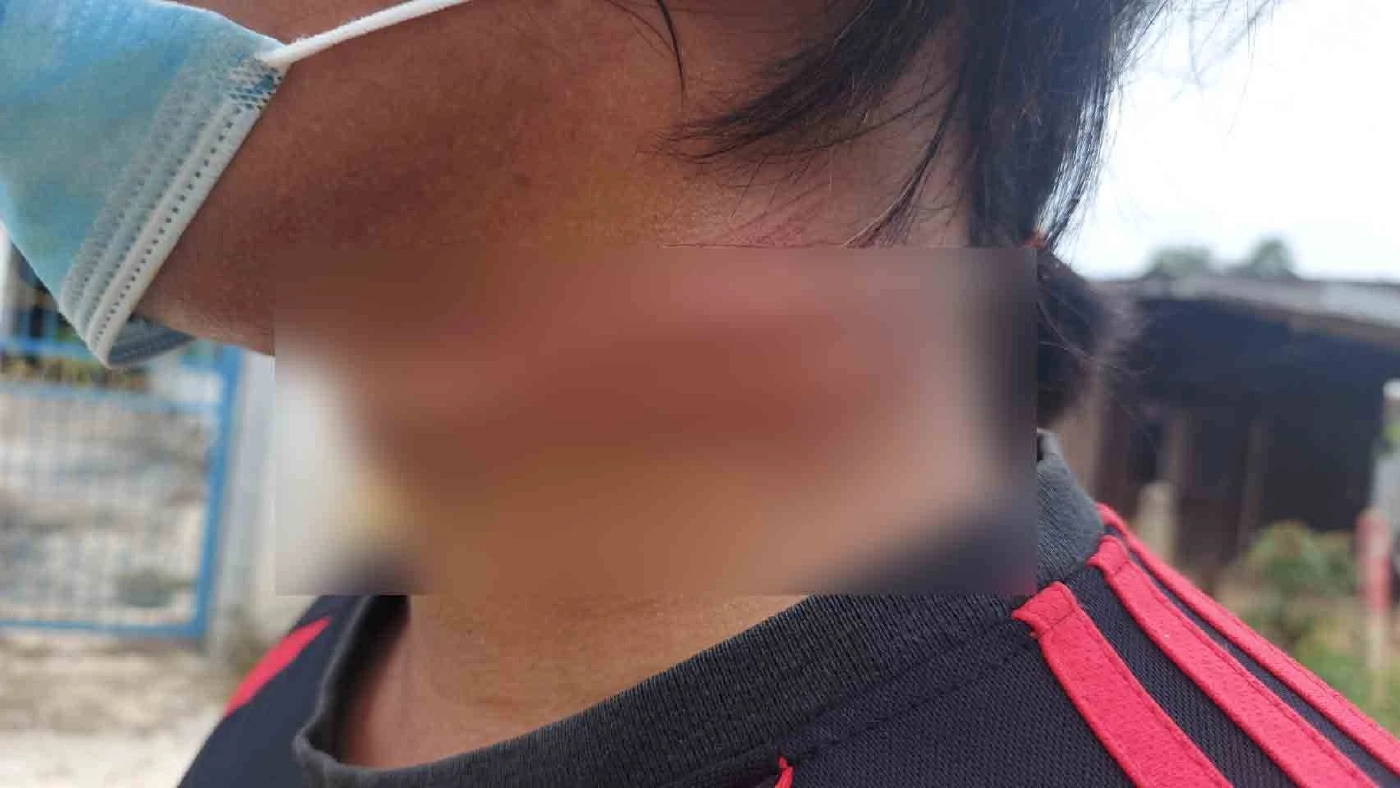 หนุ่มหวิดคอขาด เจอมือดีใช้สายสื่อสารขึงกลางถนนในหมู่บ้าน