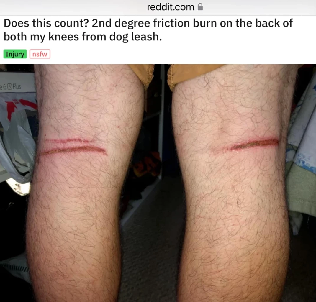 “หมอธวัชชัย” โพสต์ภาพ “แผลจากเชือก” เทียบชัดแผลก้างปลา “แตงโม”