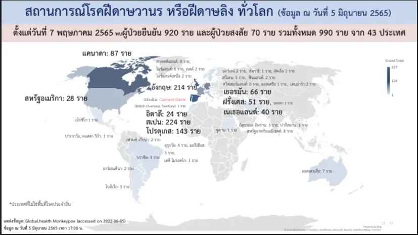 สธ. เผย ทั่วโลกพบผู้ป่วยยืนยัน “โรคฝีดาษลิง” 920 คน ใน 43 ประเทศ