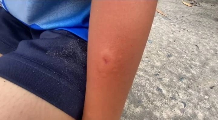 เด็กหญิงวัย11ขวบ โดนต่อหัวเสือนับ10ตัวรุมต่อยแทบหมดสติ