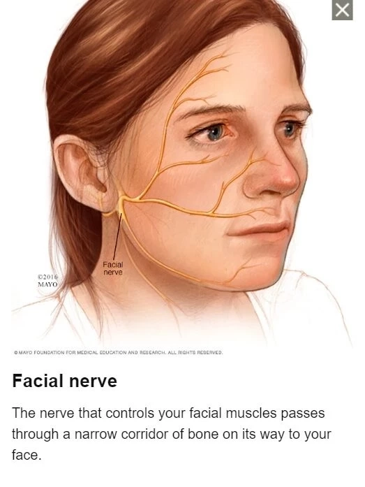 ขอขอบคุณเครดิตภาพจาก Mayo Clinic