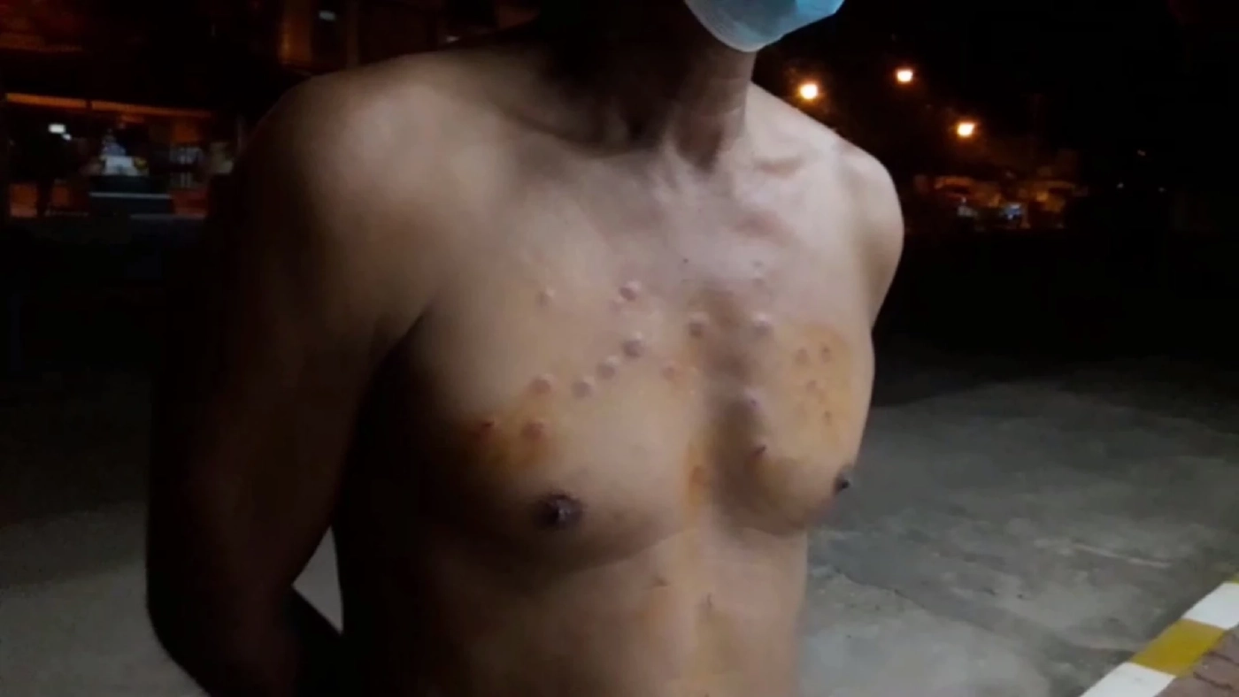 อึ้ง! ชายวัย 57 ปี ถูกคู่กรณีลั่นไกปืนใส่หน้าอก 30 นัด แต่ยิงไม่เข้า 