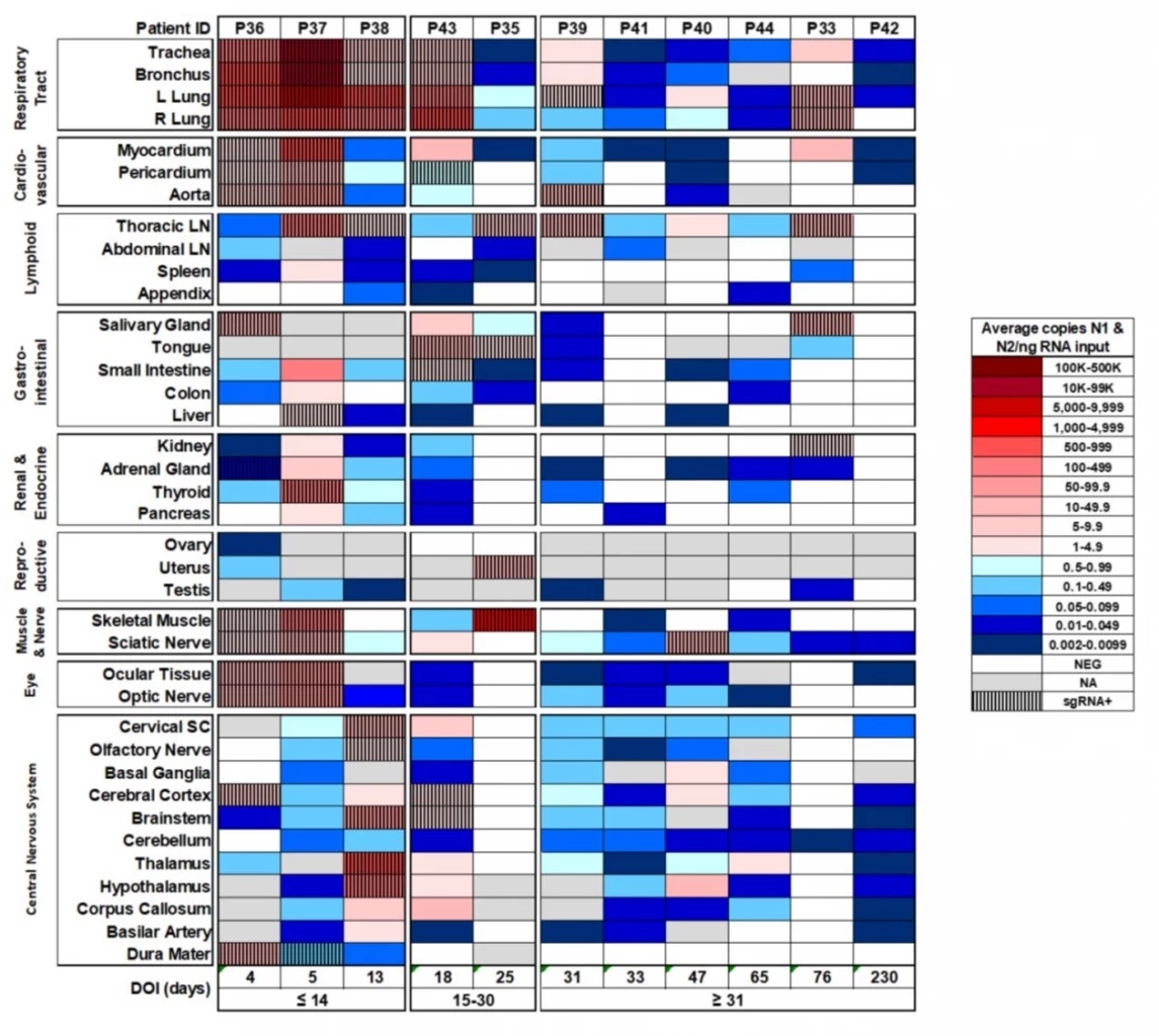 หมอธีระ เปิดงานวิจัยสหรัฐฯ "โควิด"ทำลายระบบใด พร้อมช่วงเวลาเหมาะฉีดวัคซีน