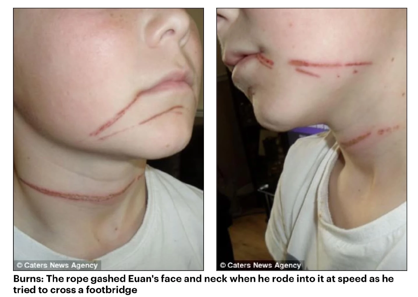 “หมอธวัชชัย” โพสต์ภาพ “แผลจากเชือก” เทียบชัดแผลก้างปลา “แตงโม”