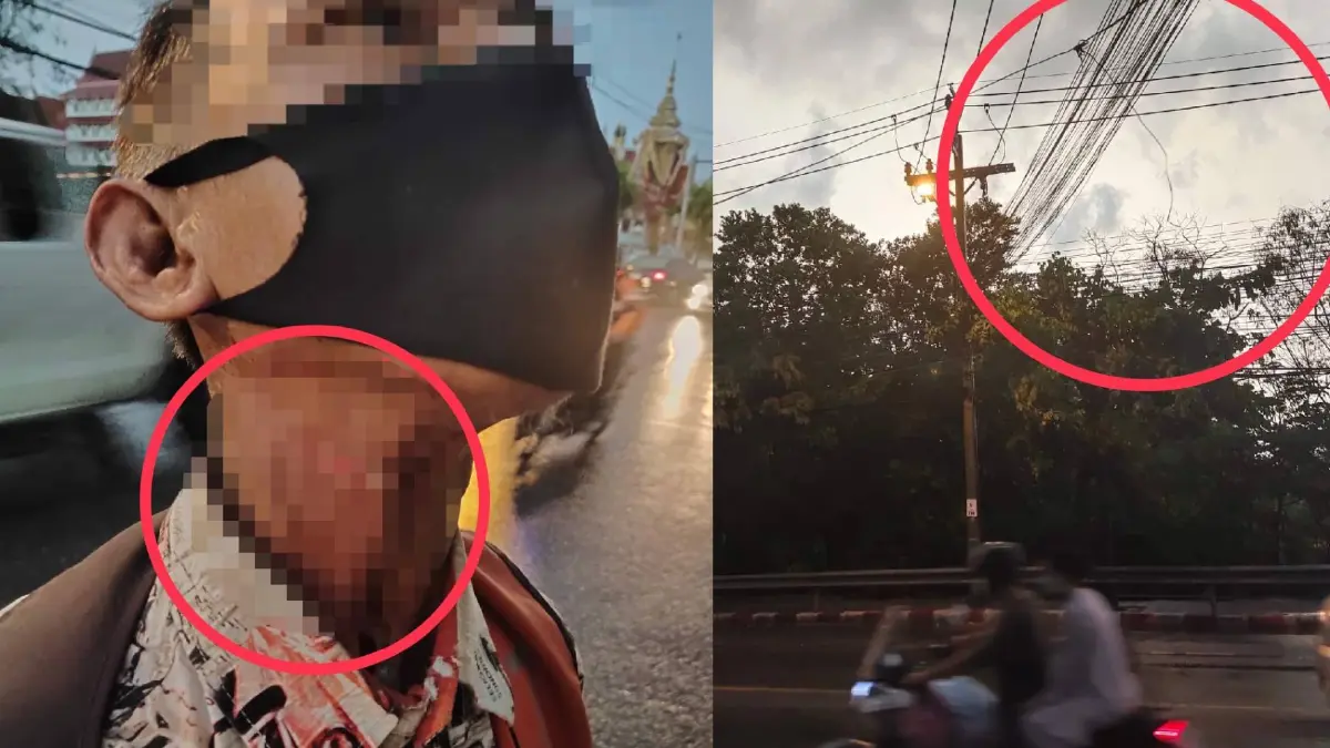 “เพจสายไหมต้องรอด” พาลุงดำ เหยื่อสายเคเบิลพาดคอ ร้องตำรวจ