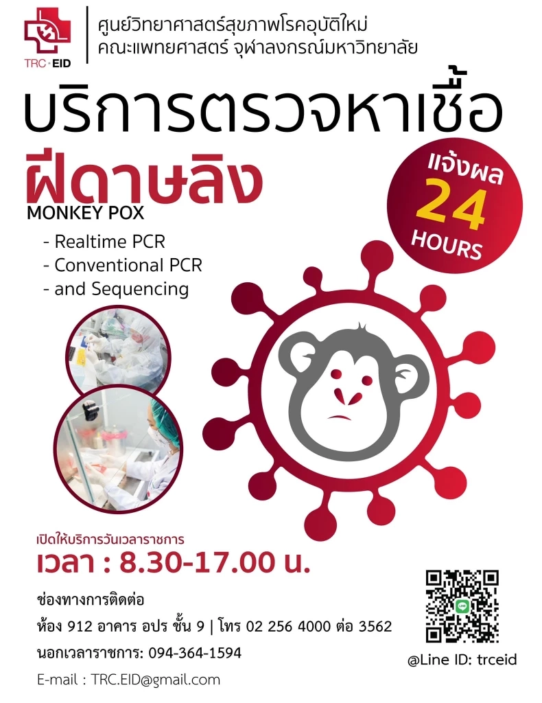 เปิดเงื่อนไข คณะแพทย์ จุฬาฯ รับตรวจ "ฝีดาษลิง" พร้อมแจ้งผลใน 24 ชั่วโมง