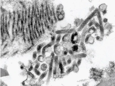 รู้ทันโรคติดเชื้อไวรัสมาร์บวร์ก สาเหตุ อาการ และวิธีป้องกัน ต้องทำอย่างไร