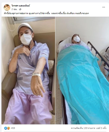 ด่วน เผยอาการล่าสุด พี่ปุ้ม ไกรสร แสงอนันต์ หลังตรวจพบชิ้นเนื้อในลำไส้