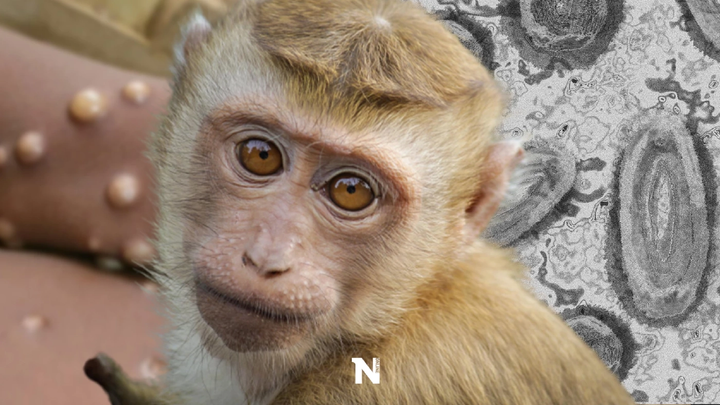 เปิดเงื่อนไข คณะแพทย์ จุฬาฯ รับตรวจ "ฝีดาษลิง" พร้อมแจ้งผลใน 24 ชั่วโมง