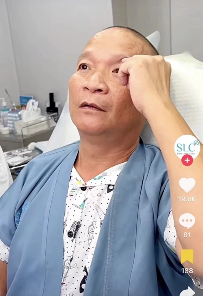 หล่อเลยป๋า "หม่ำ จ๊กมก" ทำหน้าครั้งแรกในชีวิต เหตุ หนังตาตกจนบังตาดำมิด