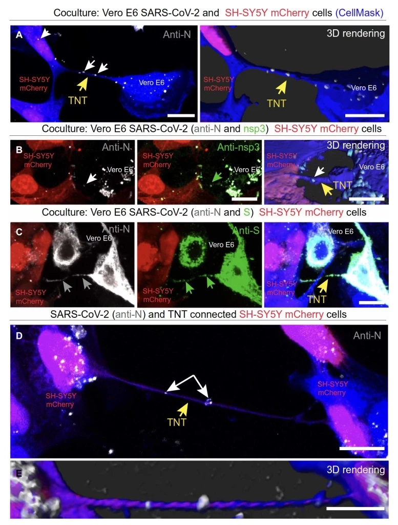 หมอธีระ เตือน "โอมิครอน" ติดเชื้อซ้ำง่าย แพร่จากเซลล์สมองไปได้ทั่วร่างกาย