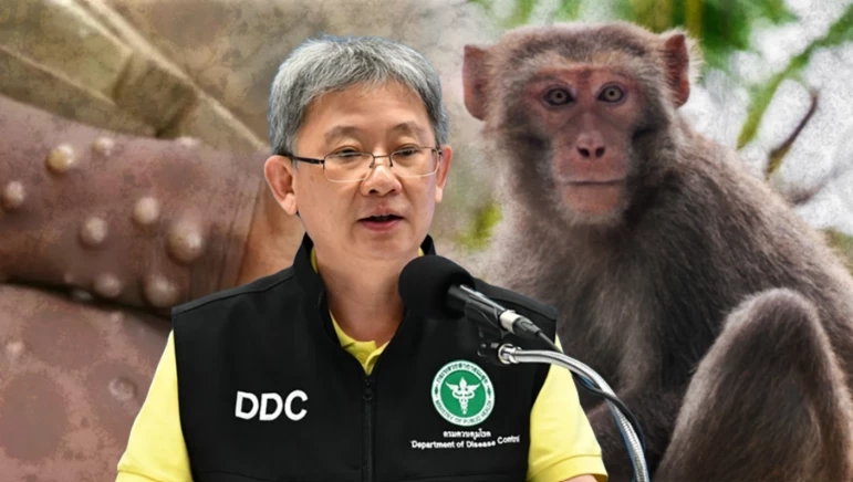 นยันพบ "ฝีดาษวานร" รายแรกของไทย กรมควบคุมโรคลงพื้นที่สอบสวนโรคแล้ว